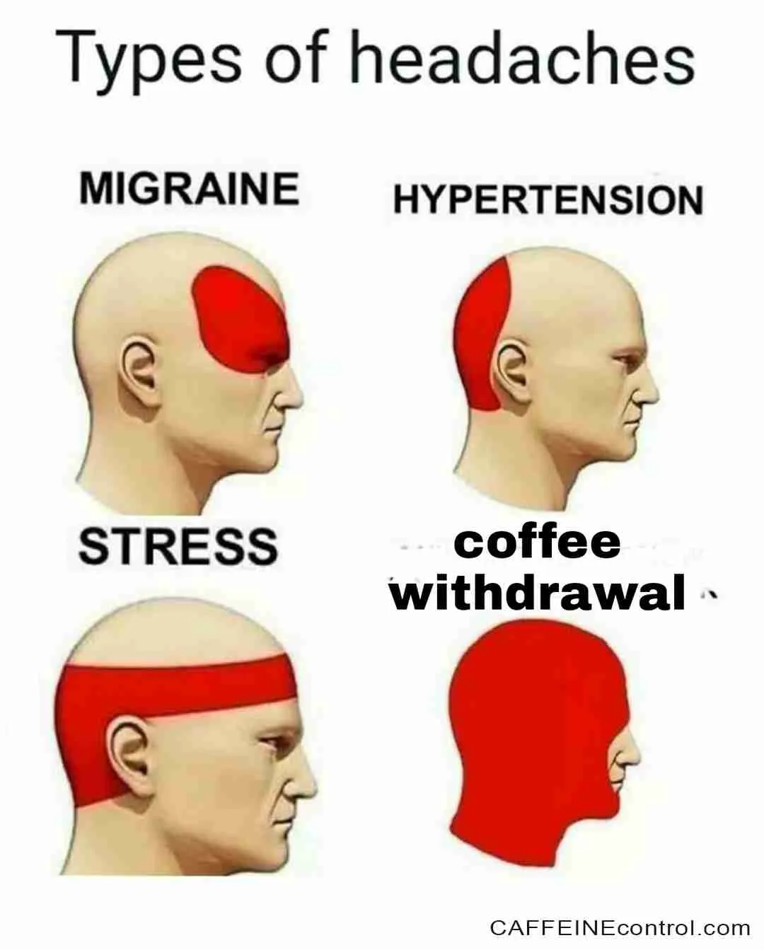 caffeine withdrawal headache location